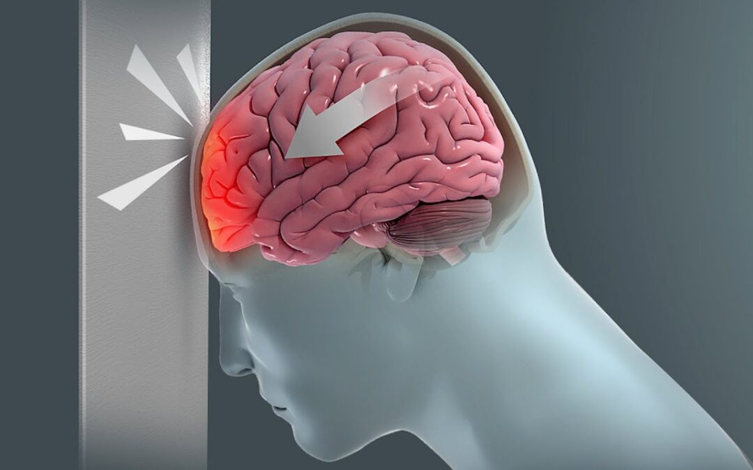 first aid head injury treatment